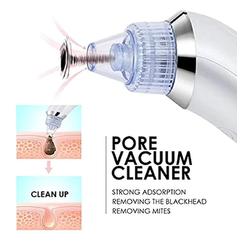 Blackhead Remover Pore Vacuum Cleaner - Rechargeable